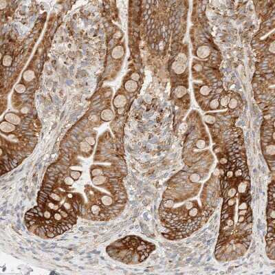 Immunohistochemistry-Paraffin: LLGL2 Antibody [NBP1-81753]