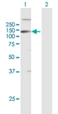 Western Blot: LLGL2 Antibody [H00003993-B01P]