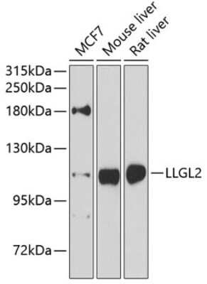 Western Blot: LLGL2 AntibodyBSA Free [NBP3-05135]