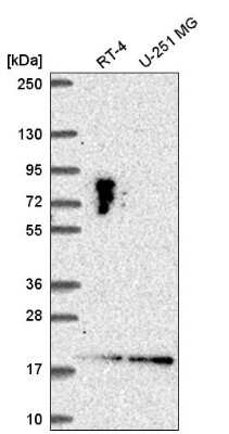 Western Blot: LLPH Antibody [NBP2-55472]