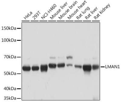 Western Blot: LMAN1 Antibody (3A1X6) [NBP3-16517]