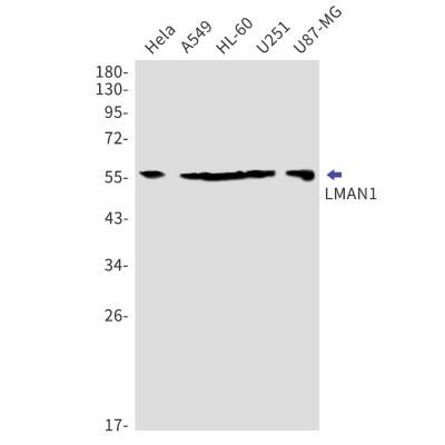 Western Blot: LMAN1 Antibody (S03-5C3) [NBP3-19885]