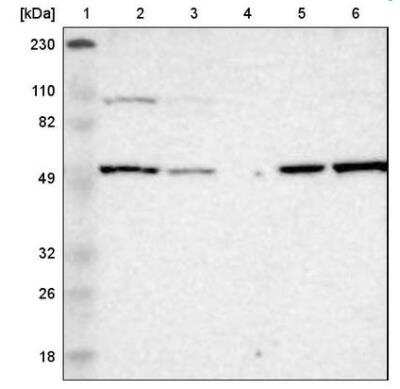 Western Blot: LMAN1 Antibody [NBP1-84812]