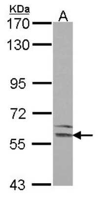 Western Blot: LMAN1 Antibody [NBP2-19366]