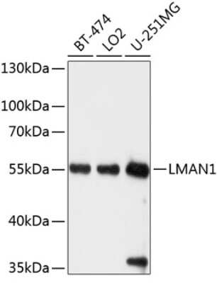 Western Blot: LMAN1 AntibodyAzide and BSA Free [NBP3-04910]