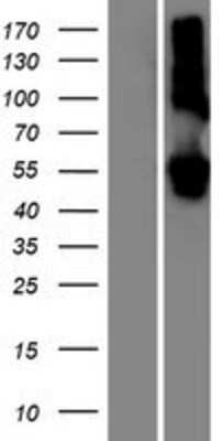 Western Blot: LMAN1L/SLAMP Overexpression Lysate [NBP2-06513]