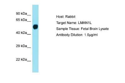 Western Blot: LMAN1L/SLAMP Antibody [NBP2-84138]