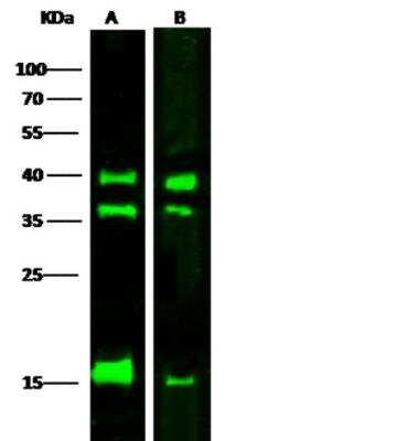 Western Blot: LMAN2 Antibody (02) [NBP3-05830]