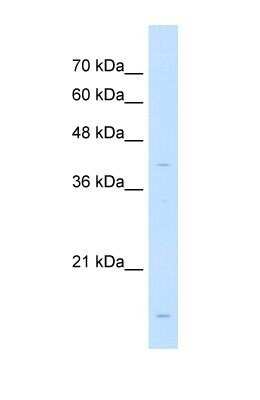 Western Blot: LMAN2 Antibody [NBP1-69474]