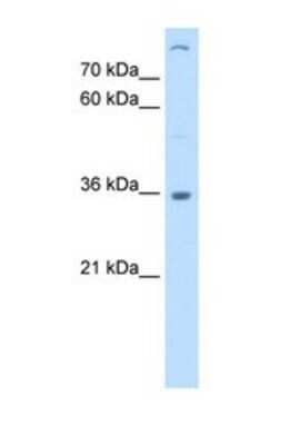 Western Blot: LMAN2 Antibody [NBP1-69475]