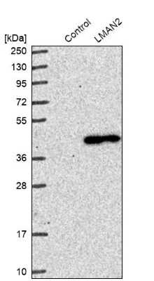 Western Blot: LMAN2 Antibody [NBP1-86768]