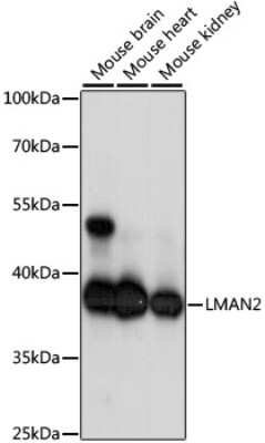 Western Blot: LMAN2 AntibodyAzide and BSA Free [NBP3-04813]