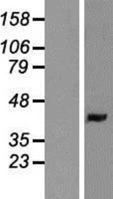 Western Blot: LMAN2 Overexpression Lysate [NBP2-07575]