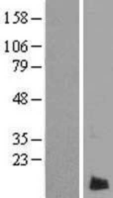 Western Blot: LMAN2L Overexpression Lysate [NBP2-06181]