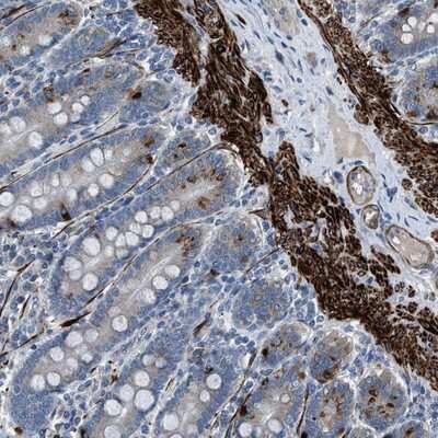 Immunohistochemistry-Paraffin: LMBR1 Antibody [NBP1-89276]