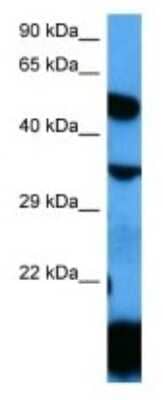 Western Blot: LMBR1L Antibody [NBP3-10011]