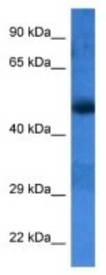 Western Blot: LMBR1L Antibody [NBP3-10022]