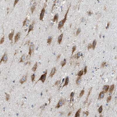 Immunohistochemistry-Paraffin: LMBRD1 Antibody [NBP1-88729]