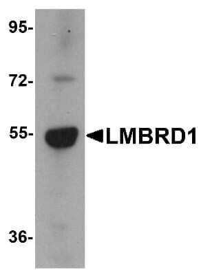 Western Blot: LMBRD1 AntibodyBSA Free [NBP1-76494]