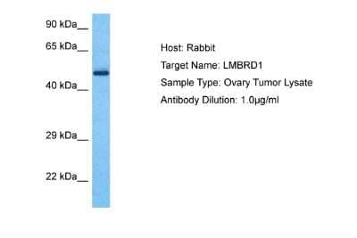 Western Blot: LMBRD1 Antibody [NBP2-85219]