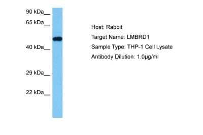 Western Blot: LMBRD1 Antibody [NBP2-85220]