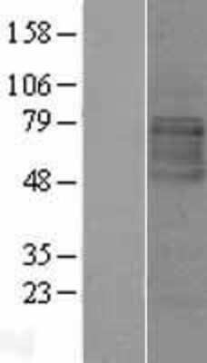 Western Blot: LMBRD1 Overexpression Lysate [NBL1-12560]