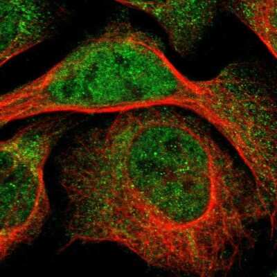 Immunocytochemistry/ Immunofluorescence: LMBRD2 Antibody [NBP1-90551]