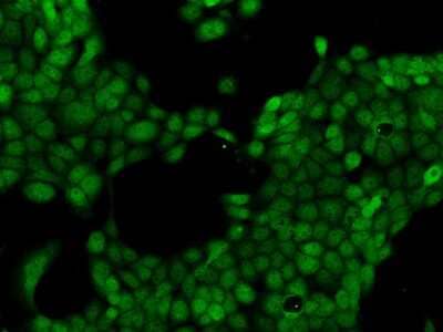 Immunocytochemistry/ Immunofluorescence: LMBRD2 Antibody [NBP3-06641]