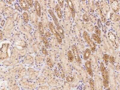 Immunohistochemistry: LMBRD2 Antibody [NBP3-06641]