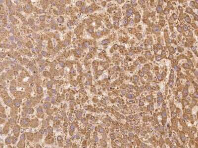 Immunohistochemistry: LMBRD2 Antibody [NBP3-06641]