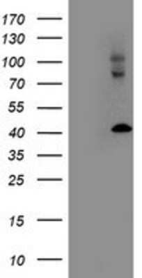 Western Blot: LMCD1 Antibody (OTI1H5) [NBP2-00934]