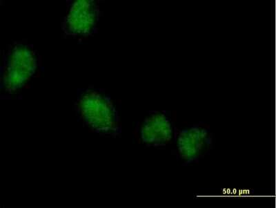 Immunocytochemistry/ Immunofluorescence: LMCD1 Antibody [H00029995-B01P]