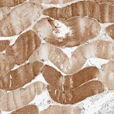 Immunohistochemistry-Paraffin: LMCD1 Antibody [NBP1-85986]