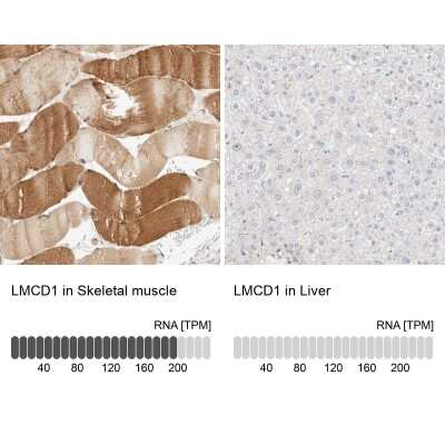 Immunohistochemistry-Paraffin: LMCD1 Antibody [NBP1-85986]