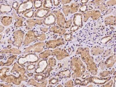 Immunohistochemistry-Paraffin: LMCD1 Antibody [NBP2-97210]