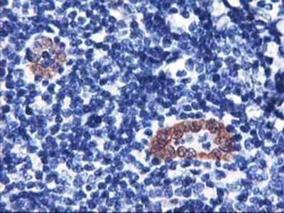 Immunohistochemistry: LMCD1 Antibody (OTI1H5) - Azide and BSA Free [NBP2-71865]