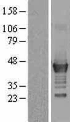 Western Blot: LMCD1 Overexpression Lysate [NBL1-12561]