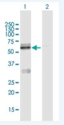 Western Blot: LMF1 Antibody [H00064788-B01P-50ug]