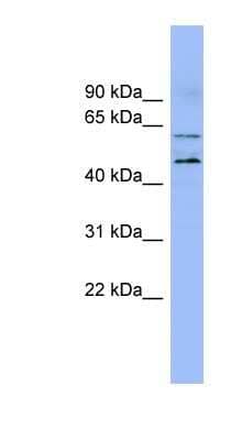 Western Blot: LMF1 Antibody [NBP1-62445]