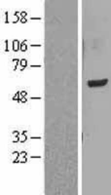 Western Blot: LMF1 Overexpression Lysate [NBL1-12562]