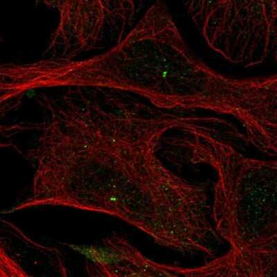 Immunocytochemistry/ Immunofluorescence: LMF2 Antibody [NBP2-37996]