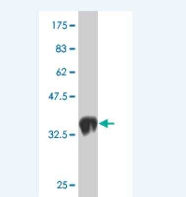 Western Blot: LMO1 Antibody (1A9) [H00004004-M02]