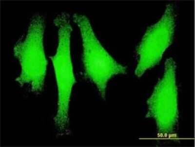 Immunocytochemistry/ Immunofluorescence: LMO1 Antibody (4F7) [H00004004-M01]