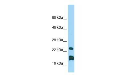 Western Blot: LMO1 Antibody [NBP2-82275]