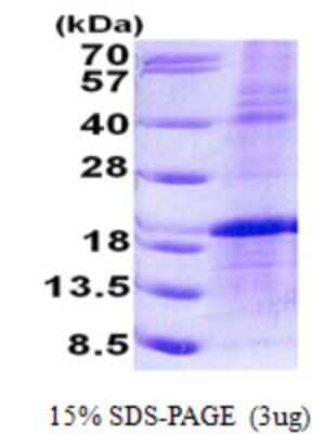 SDS-PAGE: Recombinant Human LMO1 His Protein [NBP2-23194]