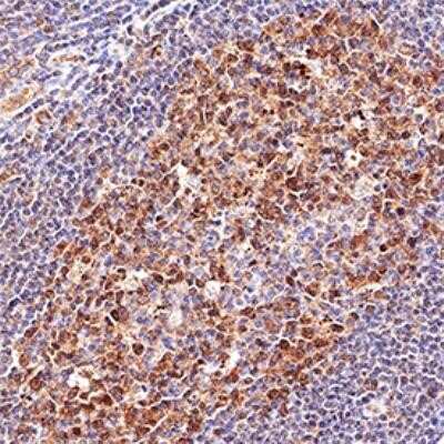 Immunohistochemistry-Paraffin: LMO2 Antibody (1A9-3B11) - Azide and BSA Free [NBP2-80835]