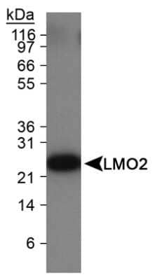 Western Blot: LMO2 Antibody (1A9-3B11)Azide and BSA Free [NBP2-80835]