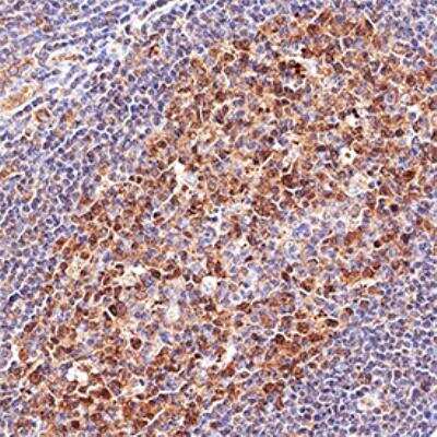 Immunohistochemistry-Paraffin: LMO2 Antibody (1A9-3B11) - BSA Free [NB110-78626]