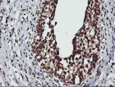 Immunohistochemistry: LMO2 Antibody (OTI1G10) [NBP2-45787]