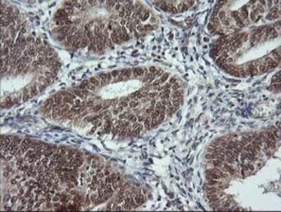 Immunohistochemistry: LMO2 Antibody (OTI1G10) [NBP2-45787]